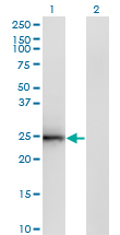 CIDEB Antibody - Western blot of CIDEB expression in transfected 293T cell line by CIDEB monoclonal antibody (M01), clone 2A10.