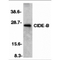 CIDEB Antibody - Western blot analysis of CIDE-B in mouse liver tissue lysate with CIDE-B antibody at 1:500 dilution.