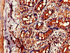 CIDEB Antibody - Immunohistochemistry of paraffin-embedded human small intestine tissue using CIDEB Antibody at dilution of 1:100