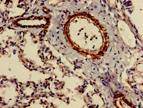 CIDEB Antibody - Immunohistochemistry of paraffin-embedded human lung tissue using CIDEB Antibody at dilution of 1:100