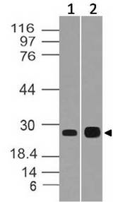 CIDEB Antibody - Fig-1: Western blot analysis of CIDE-B. Anti- CIDE-B antibody was used at 1 µg/ml on (1) h Kidney and (2) HT-29 lysates.