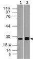 CIDEB Antibody - Fig-1: Western blot analysis of CIDE-B. Anti- CIDE-B antibody was used at 1 µg/ml on (1) h Kidney and (2) HT-29 lysates.