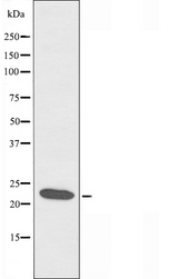 CIDEB Antibody - Western blot analysis of extracts of RAW264.7 cells using CIDEB antibody.