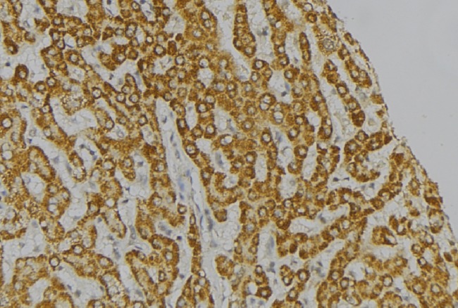 CIDEB Antibody - 1:100 staining mouse liver tissue by IHC-P. The sample was formaldehyde fixed and a heat mediated antigen retrieval step in citrate buffer was performed. The sample was then blocked and incubated with the antibody for 1.5 hours at 22°C. An HRP conjugated goat anti-rabbit antibody was used as the secondary.