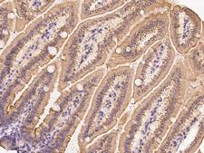 CIDEB Antibody - Immunochemical staining of mouse Cideb in mouse small intestine with rabbit polyclonal antibody at 1:300 dilution, formalin-fixed paraffin embedded sections.
