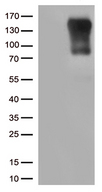 CIITA Antibody - HEK293T cells were transfected with the pCMV6-ENTRY control. (Left lane) or pCMV6-ENTRY CIITA. (Right lane) cDNA for 48 hrs and lysed. Equivalent amounts of cell lysates. (5 ug per lane) were separated by SDS-PAGE and immunoblotted with anti-CIITA. (1:500)