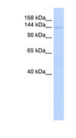 CIITA Antibody - CIITA antibody Western blot of Fetal Liver lysate. This image was taken for the unconjugated form of this product. Other forms have not been tested.
