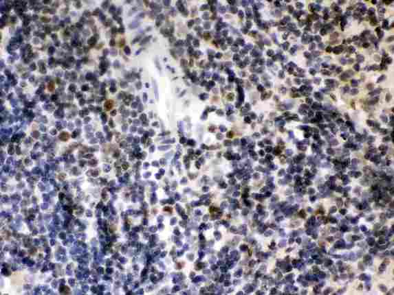 CIITA Antibody - CIITA was detected in paraffin-embedded sections of rat spleen tissues using rabbit anti- CIITA Antigen Affinity purified polyclonal antibody