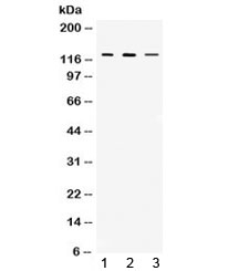 CIITA Antibody - Western blot testing of 1) rat thymus, 2) mouse thymus and 3) MCF7 lysate with CIITA antibody at 0.5ug/ml. Predicted/observed molecular weight ~123 kDa.