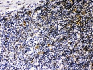 CIITA Antibody - IHC testing of FFPE mouse spleen with CIITA antibody at 1ug/ml. HIER: steam in pH6 citrate buffer and allow to cool prior to staining.