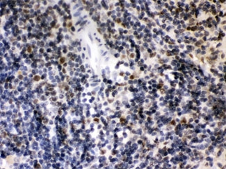 CIITA Antibody - IHC testing of FFPE rat spleen with CIITA antibody at 1ug/ml. HIER: steam in pH6 citrate buffer and allow to cool prior to staining.