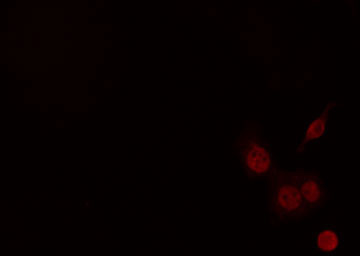 CIITA Antibody - Staining HeLa cells by IF/ICC. The samples were fixed with PFA and permeabilized in 0.1% Triton X-100, then blocked in 10% serum for 45 min at 25°C. The primary antibody was diluted at 1:200 and incubated with the sample for 1 hour at 37°C. An Alexa Fluor 594 conjugated goat anti-rabbit IgG (H+L) antibody, diluted at 1/600, was used as secondary antibody.