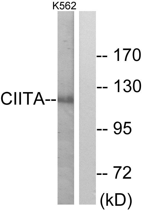 CIITA Antibody - Western blot analysis of extracts from K562 cells, using CIITA antibody.