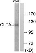 CIITA Antibody - Western blot analysis of extracts from K562 cells, using CIITA antibody.