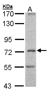 CILD9 / DNAI2 Antibody - Sample (30 ug of whole cell lysate). A: Molt-4 . 7.5 % SDS PAGE. CILD9 / DNAI2 antibody diluted at 1:1000