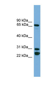 CILD9 / DNAI2 Antibody - DNAI2 antibody Western blot of PANC1 cell lysate.  This image was taken for the unconjugated form of this product. Other forms have not been tested.