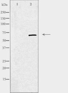 CILD9 / DNAI2 Antibody - Western blot analysis of extracts of LOVO cells using DNAI2 antibody.