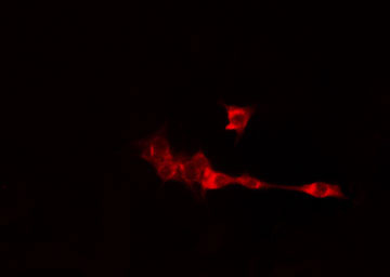 CILD9 / DNAI2 Antibody - Staining LOVO cells by IF/ICC. The samples were fixed with PFA and permeabilized in 0.1% Triton X-100, then blocked in 10% serum for 45 min at 25°C. The primary antibody was diluted at 1:200 and incubated with the sample for 1 hour at 37°C. An Alexa Fluor 594 conjugated goat anti-rabbit IgG (H+L) antibody, diluted at 1/600, was used as secondary antibody.