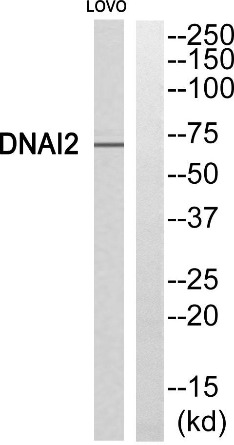 CILD9 / DNAI2 Antibody - Western blot analysis of extracts from LOVO cells, using DNAI2 antibody.