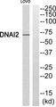 CILD9 / DNAI2 Antibody - Western blot analysis of extracts from LOVO cells, using DNAI2 antibody.