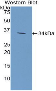 CILP Antibody - Western blot of recombinant CILP.  This image was taken for the unconjugated form of this product. Other forms have not been tested.