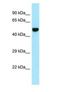 CILP Antibody - CILP antibody Western Blot of 721_B.  This image was taken for the unconjugated form of this product. Other forms have not been tested.