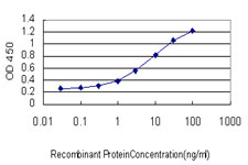 CILP Antibody - Detection limit for recombinant GST tagged CILP is approximately 0.1 ng/ml as a capture antibody.