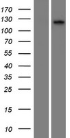 CILP2 Protein - Western validation with an anti-DDK antibody * L: Control HEK293 lysate R: Over-expression lysate