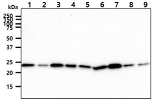 CINP Antibody - The cell lysates (40ug) were resolved by SDS-PAGE, transferred to PVDF membrane and probed with anti-human CINP antibody (1:1000). Proteins were visualized using a goat anti-mouse secondary antibody conjugated to HRP and an ECL detection system. Lane 1.: Jurkat cell lysate Lane 2.: K562 cell lysate Lane 3.: 293T cell lysate Lane 4.: HepG2 cell lysate Lane 5.: A549 cell lysate Lane 6.: MCF7 cell lysate Lane 7.: LnCap cell lysate Lane 8.: HeLa cell lysate Lane 9.: SK-OV-3 cell lysate
