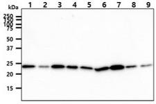 CINP Antibody - The cell lysates (40ug) were resolved by SDS-PAGE, transferred to PVDF membrane and probed with anti-human CINP antibody (1:1000). Proteins were visualized using a goat anti-mouse secondary antibody conjugated to HRP and an ECL detection system. Lane 1.: Jurkat cell lysate Lane 2.: K562 cell lysate Lane 3.: 293T cell lysate Lane 4.: HepG2 cell lysate Lane 5.: A549 cell lysate Lane 6.: MCF7 cell lysate Lane 7.: LnCap cell lysate Lane 8.: HeLa cell lysate Lane 9.: SK-OV-3 cell lysate
