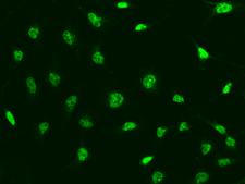 CINP Antibody - Immunofluorescence staining of CINP in HeLa cells. Cells were fixed with 4% PFA, permeabilzed with 0.1% Triton X-100 in PBS, blocked with 10% serum, and incubated with rabbit anti-Human CINP polyclonal antibody (dilution ratio 1:500) at 4°C overnight. Then cells were stained with the Alexa Fluor 488-conjugated Goat Anti-rabbit IgG secondary antibody (green).