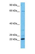 CINP Antibody - Western blot of CINP Antibody with human MCF7 Whole Cell lysate.  This image was taken for the unconjugated form of this product. Other forms have not been tested.