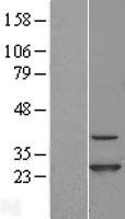 CINP Protein - Western validation with an anti-DDK antibody * L: Control HEK293 lysate R: Over-expression lysate