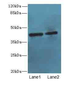 CIPC / KIAA1737 Antibody - Western blot. All lanes: CIPC antibody at 6 ug/ml. Lane 1: A431 whole cell lysate. Lane 2: NIH/3T3 whole cell lysate. Secondary Goat polyclonal to Rabbit IgG at 1:10000 dilution. Predicted band size: 43 kDa. Observed band size: 43 kDa.