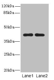 CIPC / KIAA1737 Antibody - Western blot All lanes: CIPC antibody at 6µg/ml Lane 1: A431 whole cell lysate Lane 2: NIH/3T3 whole cell lysate Secondary Goat polyclonal to rabbit IgG at 1/10000 dilution Predicted band size: 43 kDa Observed band size: 43 kDa