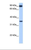 CIR1 Antibody - Fetal muscle lysate. Antibody concentration: 1.0 ug/ml. Gel concentration: 12%.  This image was taken for the unconjugated form of this product. Other forms have not been tested.