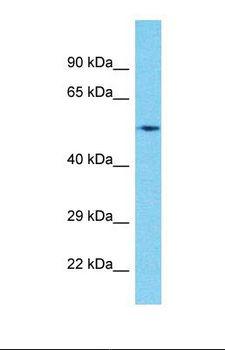 CIR1 Antibody - Western blot of Human Pancreas Tumor. CIR1 antibody dilution 1.0 ug/ml.  This image was taken for the unconjugated form of this product. Other forms have not been tested.