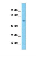 CIR1 Antibody - Western blot of Human Pancreas Tumor. CIR1 antibody dilution 1.0 ug/ml.  This image was taken for the unconjugated form of this product. Other forms have not been tested.