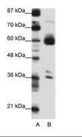 CIR1 Antibody - A: Marker, B: Transfected 293T Cell Lysate.  This image was taken for the unconjugated form of this product. Other forms have not been tested.