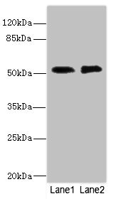CIR1 Antibody - Western blot All Lanes: TMOD1 antibody at 2.84ug/ml Lane 1: PC-3 whole cell lysate Lane 2: 293T whole cell lysate Secondary Goat polyclonal to rabbit IgG at 1/10000 dilution Predicted band size: 53,24 kDa Observed band size: 52 kDa