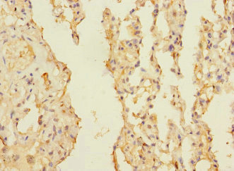 CIR1 Antibody - Immunohistochemistry of paraffin-embedded human lung tissue at dilution 1:100