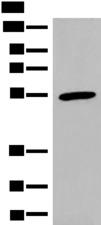 CIR1 Antibody - Western blot analysis of Human heart tissue lysate  using CIR1 Polyclonal Antibody at dilution of 1:600
