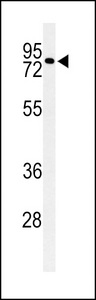 CIRH1A Antibody - Western blot of CIRH1A Antibody in Neuro-2a cell line lysates (35 ug/lane). CIRH1A (arrow) was detected using the purified antibody.