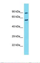CIRH1A Antibody - Western blot of Human 721_B. CIRH1A antibody dilution 1.0 ug/ml.  This image was taken for the unconjugated form of this product. Other forms have not been tested.