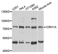CIRH1A Antibody - Western blot analysis of extracts of various cells.