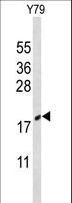 CIRP / CIRBP Antibody - Western blot of CIRBP Antibody in Y79 cell line lysates (35 ug/lane). CIRBP (arrow) was detected using the purified antibody.