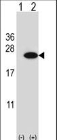 CIRP / CIRBP Antibody - Western blot of CIRBP (arrow) using rabbit polyclonal CIRBP Antibody. 293 cell lysates (2 ug/lane) either nontransfected (Lane 1) or transiently transfected (Lane 2) with the CIRBP gene.