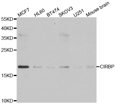 CIRP / CIRBP Antibody - Western blot analysis of extracts of various cell lines.