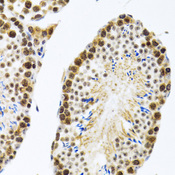 CIRP / CIRBP Antibody - Immunohistochemistry of paraffin-embedded rat testis tissue.