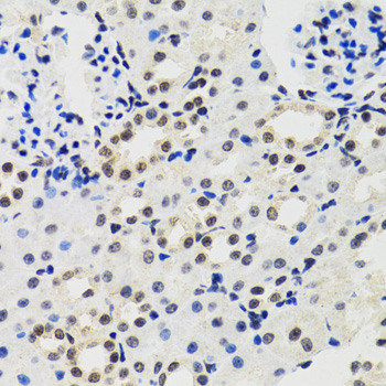CIRP / CIRBP Antibody - Immunohistochemistry of paraffin-embedded mouse kidney tissue.